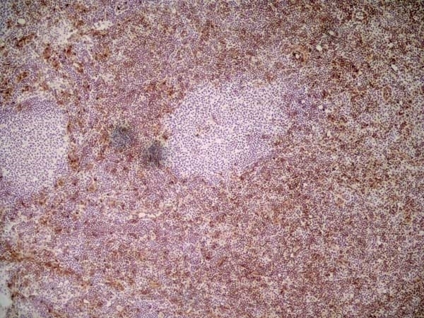 Anti Mouse Ly-6C Antibody, clone ER-MP20 thumbnail image 1