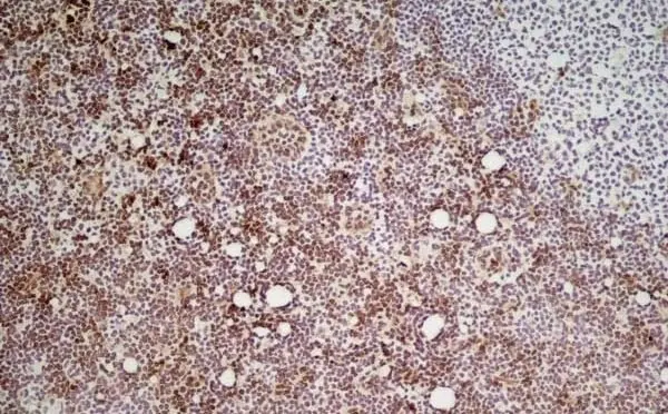 Anti Mouse Ly-6C Antibody, clone ER-MP20 gallery image 2