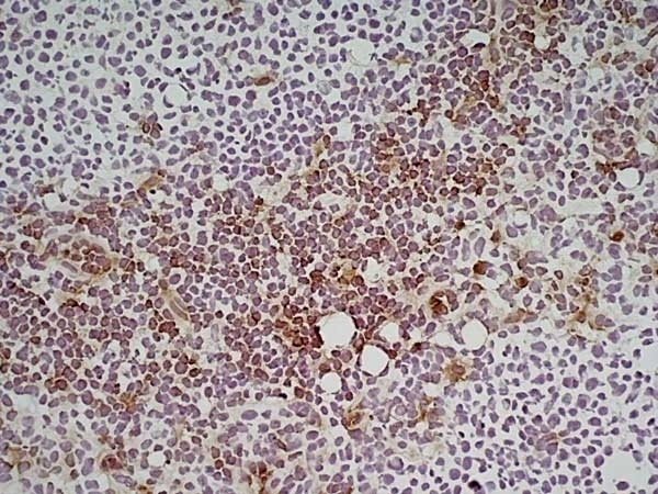 Anti Mouse Ly-6C Antibody, clone ER-MP20 gallery image 3