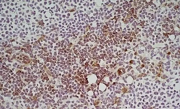 Anti Mouse Ly-6C Antibody, clone ER-MP20 gallery image 3