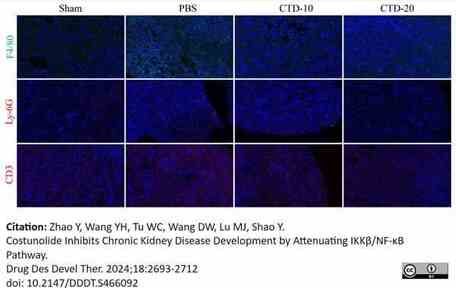 Anti Mouse Ly-6G Antibody, clone 1A8 | Bio-Rad