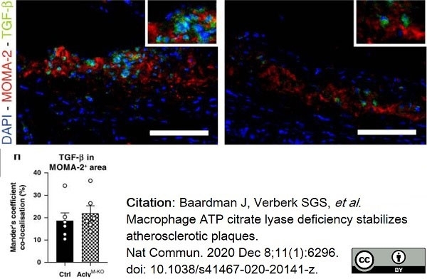 Anti Mouse Macrophages/Monocytes Antibody, clone MOMA-2 gallery image 17