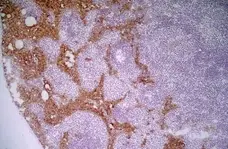 Anti Mouse MARCO Antibody, clone ED31 gallery image 3