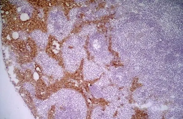 Anti Mouse MARCO Antibody, clone ED31 gallery image 3