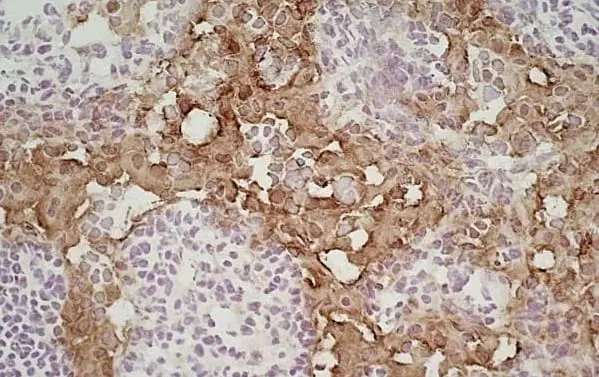 Anti Mouse MARCO Antibody, clone ED31 gallery image 5