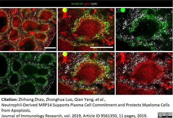 Anti Mouse MARCO Antibody, clone ED31 gallery image 9