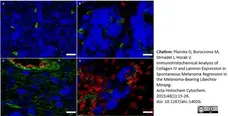 Anti Pig Endothelial Cells Antibody, clone MIL11 gallery image 3