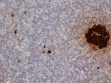 Anti Pig Insulin Antibody, clone 2D11 gallery image 1