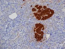 Anti Pig Insulin Antibody, clone 2D11 gallery image 2