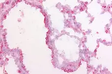 Anti Pig Surfactant Protein D Antibody, clone 1.7 gallery image 2
