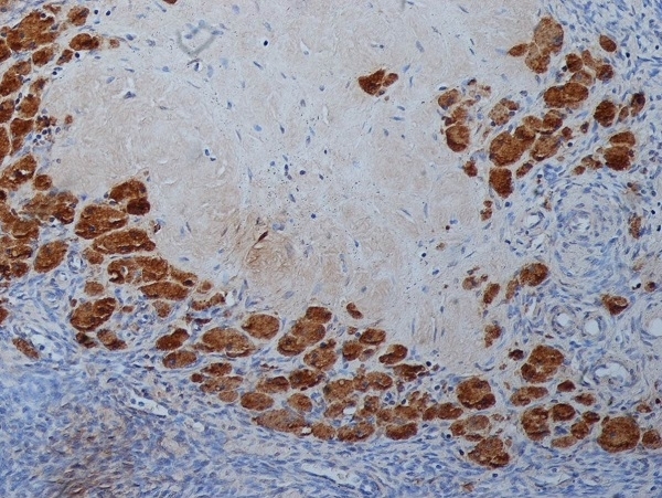 Anti Progesterone Antibody, clone 9B4 gallery image 2
