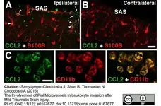 Anti Rat CD11b Antibody, clone OX-42 gallery image 18