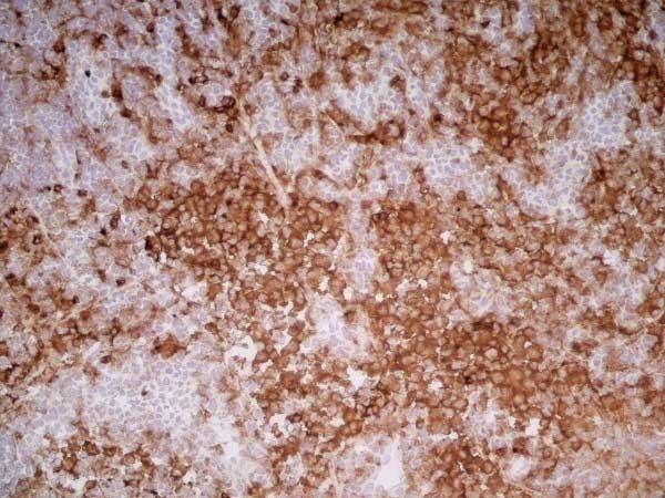 Anti Rat CD11b Antibody, clone OX-42 gallery image 3
