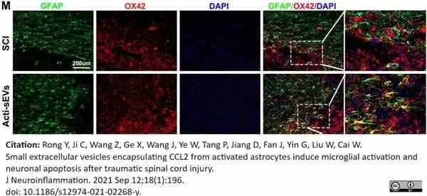 Anti Rat CD11b Antibody, clone OX-42 gallery image 45
