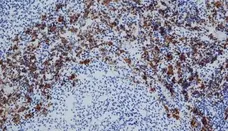 Anti Rat CD163 Antibody, clone ED2 gallery image 1