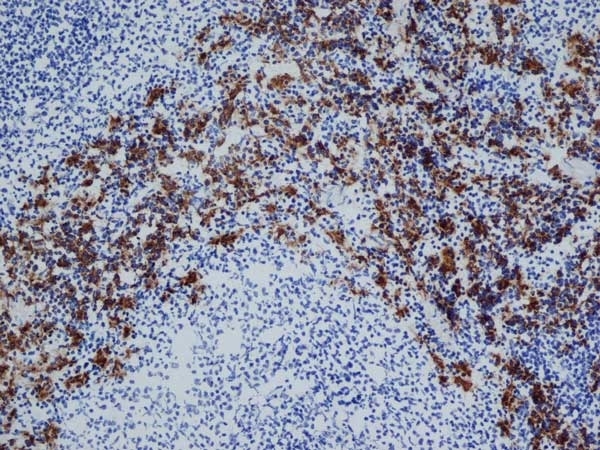 Anti Rat CD163 Antibody, clone ED2 gallery image 1