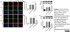 Anti Rat CD163 Antibody, clone ED2 gallery image 18