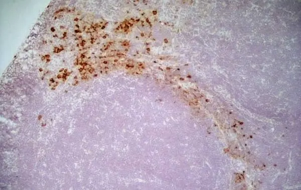 Anti Rat CD163 Antibody, clone ED2 gallery image 3