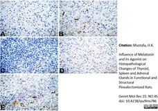 Anti Rat CD163 Antibody, clone ED2 gallery image 32