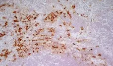 Anti Rat CD163 Antibody, clone ED2 gallery image 4