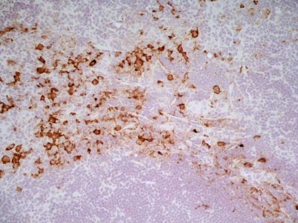 Anti Rat CD163 Antibody, clone ED2 gallery image 4