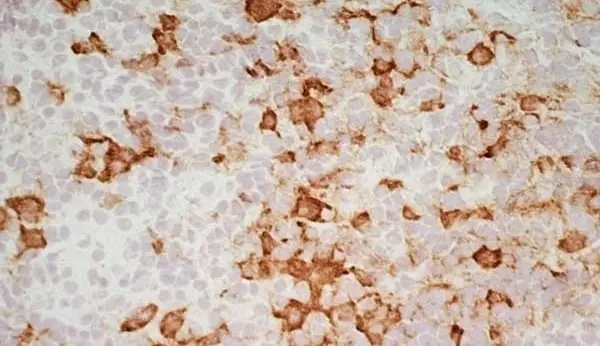 Anti Rat CD163 Antibody, clone ED2 gallery image 5
