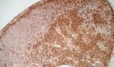 Anti Rat CD169 Antibody, clone ED3 gallery image 2