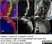 Anti Rat CD2 Antibody, clone OX-34 thumbnail image 7