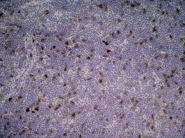 Anti Rat CD25 Antibody, clone OX-39 gallery image 6
