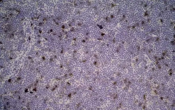 Anti Rat CD25 Antibody, clone OX-39 gallery image 6