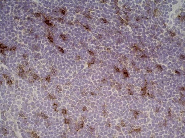 Anti Rat CD25 Antibody, clone OX-39 gallery image 7
