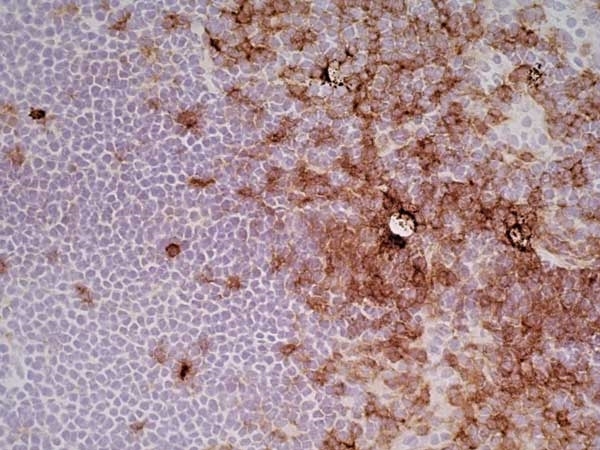 Anti Rat CD4 (Domain 2) Antibody, clone OX-35 gallery image 5
