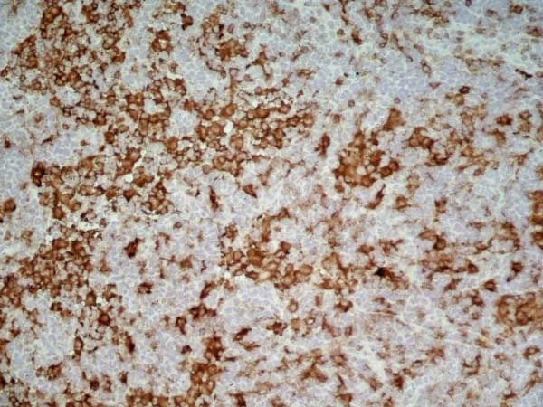 Anti Rat CD4 (Domain 1) Antibody, clone OX-38 gallery image 3