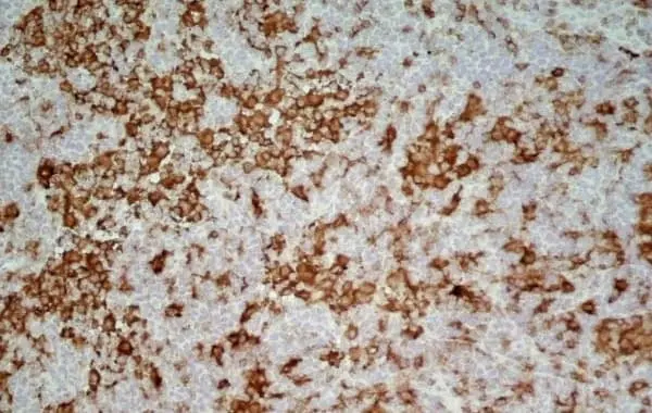 Anti Rat CD4 (Domain 1) Antibody, clone OX-38 gallery image 3