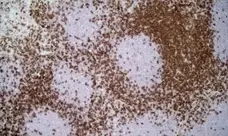 Anti Rat CD4 (Domain 1) Antibody, clone W3/25 gallery image 10
