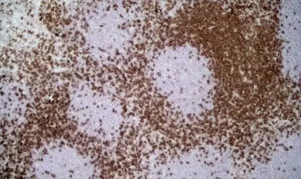 Anti Rat CD4 (Domain 1) Antibody, clone W3/25 gallery image 10