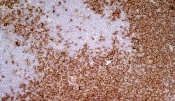Anti Rat CD4 (Domain 1) Antibody, clone W3/25 gallery image 11