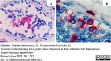 Anti Rat CD4 (Domain 1) Antibody, clone W3/25 gallery image 19