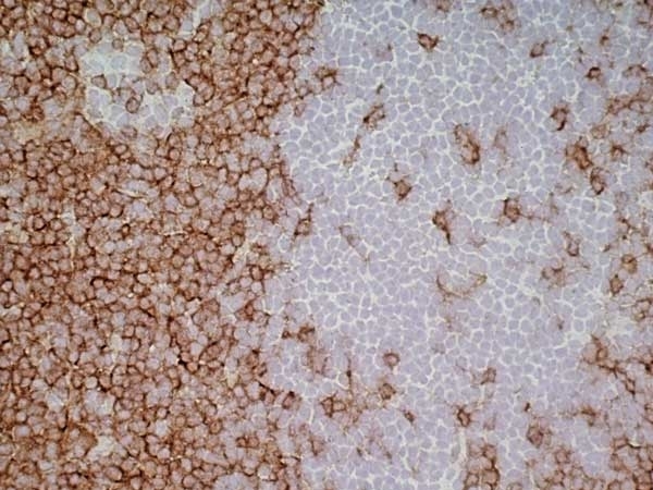 Anti Rat CD4 (Domain 1) Antibody, clone W3/25 gallery image 19