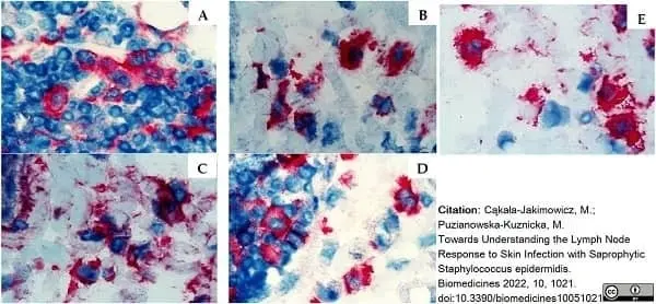 Anti Rat CD4 (Domain 1) Antibody, clone W3/25 gallery image 21