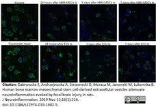 Anti Rat CD45RA (B Cells Only) Antibody, clone OX-33 gallery image 7