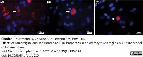 Anti Rat CD68 Antibody, clone ED1 gallery image 110