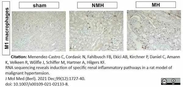 Anti Rat CD68 Antibody, clone ED1 gallery image 111