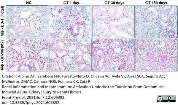 Anti Rat CD68 Antibody, clone ED1 gallery image 112