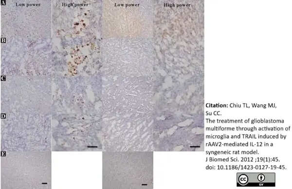 Anti Rat CD68 Antibody, clone ED1 gallery image 13
