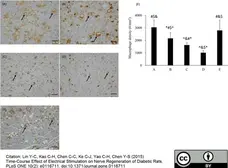 Anti Rat CD68 Antibody, clone ED1 gallery image 18