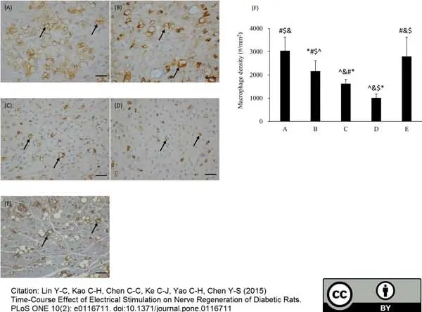 Anti Rat CD68 Antibody, clone ED1 gallery image 18