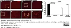 Anti Rat CD68 Antibody, clone ED1 gallery image 19