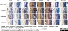 Anti Rat CD68 Antibody, clone ED1 gallery image 27