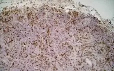 Anti Rat CD68 Antibody, clone ED1 gallery image 3